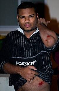 An Indian male displays his injuries after a group of males attacked him as tensions boiled over in Harris Park last night. Photo: Kate Geraghty
