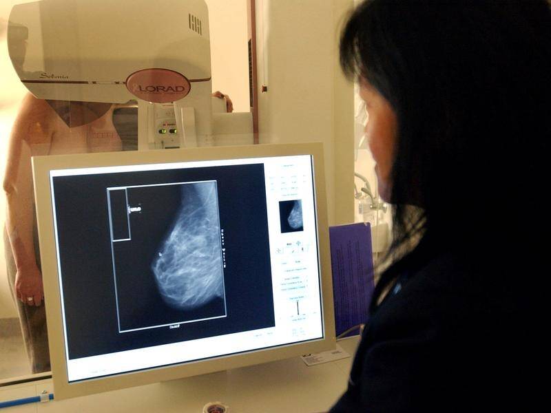 The death rate for women with breast cancer has dropped 44 per cent in 30 years.